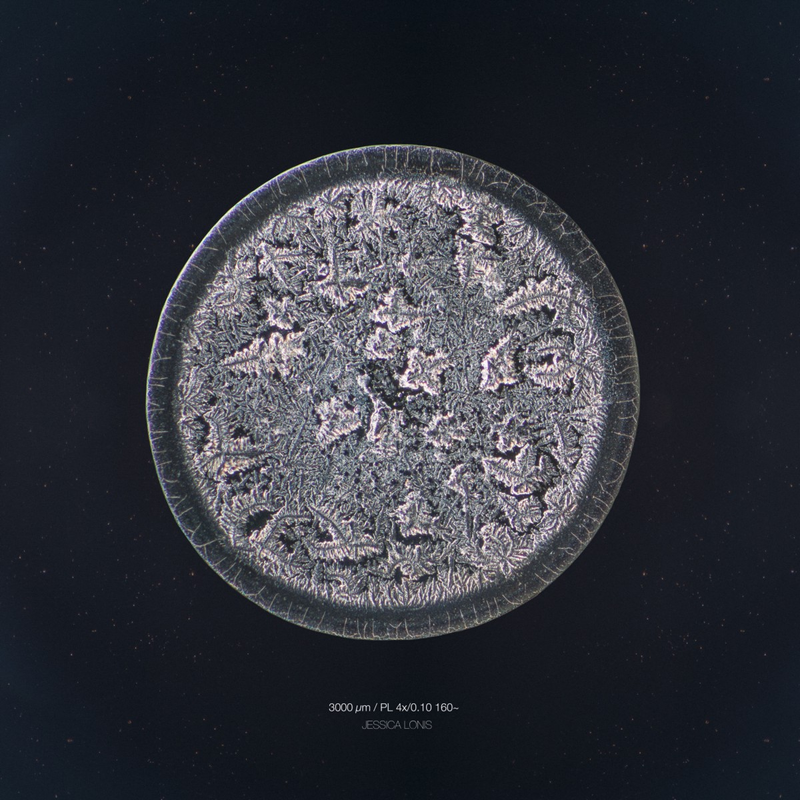 Illustration for article titled The Beautiful Secrets of Tears, Revealed By a Microscope